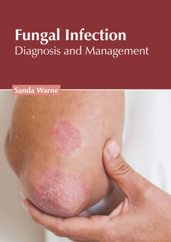 Hardcover Fungal Infection: Diagnosis and Management Book