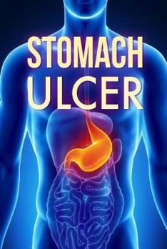 Paperback Stomach Ulcer: Treatment in 60 days!: Stomach Ulcer treatment Book