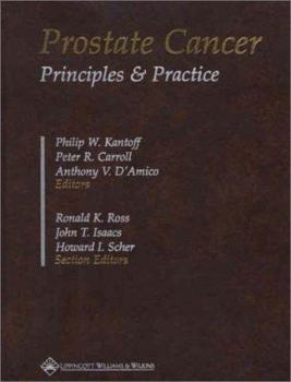 Hardcover Prostate Cancer: Principles and Practice Book