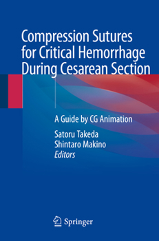 Hardcover Compression Sutures for Critical Hemorrhage During Cesarean Section: A Guide by CG Animation Book