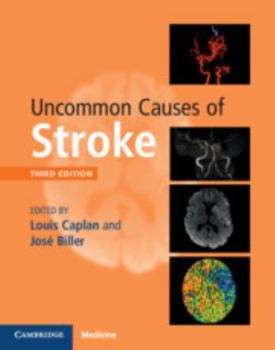 Hardcover Uncommon Causes of Stroke Book