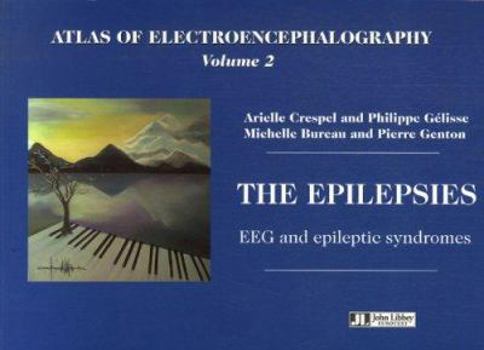 Atlas of Electroencephalography Vol 2. The Epilepsies. EEG and Epileptic Syndromes