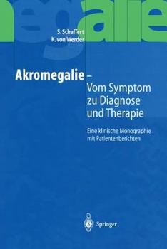 Paperback Akromegalie -- Vom Symptom Zu Diagnose Und Therapie: Eine Klinische Monographie Mit Patientenberichten [German] Book