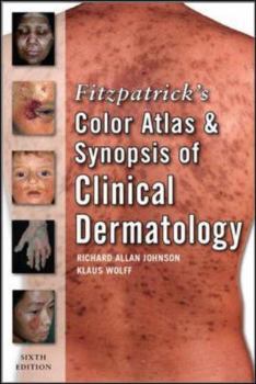 Paperback Fitzpatrick's Color Atlas and Synopsis of Clinical Dermatology Book