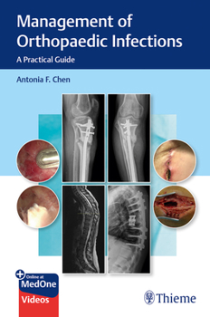 Paperback Management of Orthopaedic Infections: A Practical Guide Book