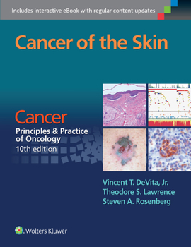 Paperback Cancer of the Skin: Cancer: Principles & Practice of Oncology, 10th Edition Book