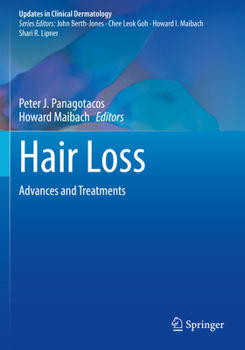 Paperback Hair Loss: Advances and Treatments Book
