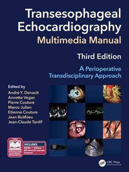 Hardcover Transesophageal Echocardiography Multimedia Manual: A Perioperative Transdisciplinary Approach Book