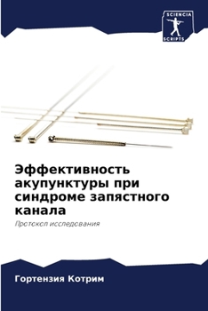 Paperback Эффективность акупункт&# [Russian] Book
