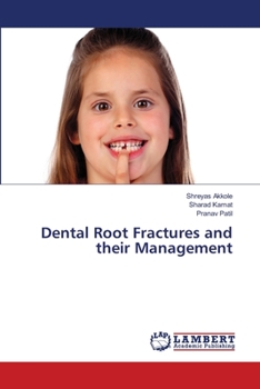 Paperback Dental Root Fractures and their Management Book