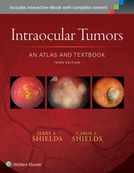 Hardcover Intraocular Tumors: An Atlas and Textbook: Volume 1 Book