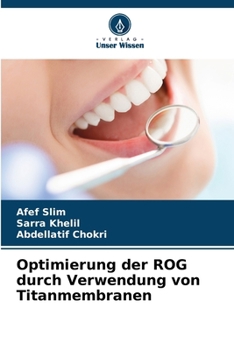 Paperback Optimierung der ROG durch Verwendung von Titanmembranen [German] Book