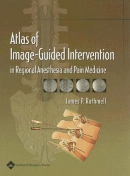 Hardcover Atlas of Image-Guided Intervention in Regional Anesthesia and Pain Medicine Book