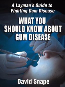 Paperback What You Should Know About Gum Disease Book