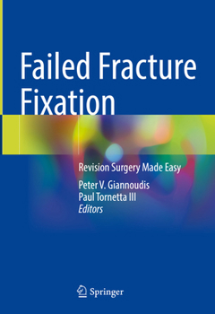 Hardcover Failed Fracture Fixation: Revision Surgery Made Easy Book