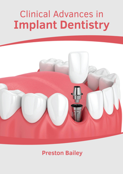 Hardcover Clinical Advances in Implant Dentistry Book