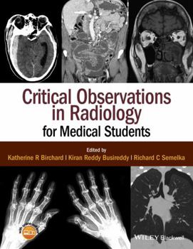 Paperback Critical Observations in Radiology for Medical Students Book