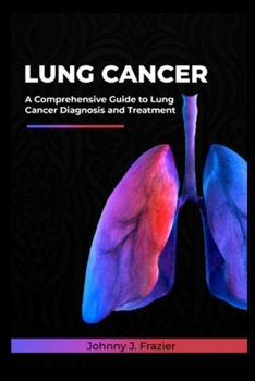 Lung cancer: A Comprehensive Guide to Lung Cancer Diagnosis and Treatment