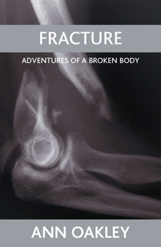 Paperback Fracture: Adventures of a Broken Body Book