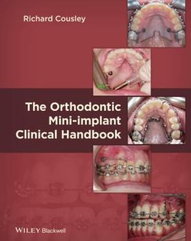 Hardcover Orthodontics Mini Implant Clin Book