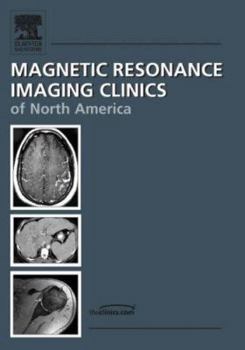 Hardcover Magnetic Resonance Imaging Clinics of North America; Vol. 14; Number 4; November 2006: MR Imaging of the Female Pelvis Book