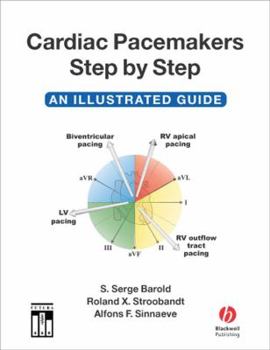 Paperback Cardiac Pacemakers Step-by-Step: An Illustrated Guide Book