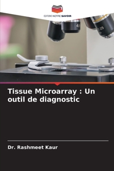 Paperback Tissue Microarray: Un outil de diagnostic [French] Book