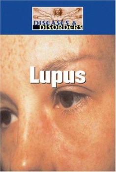 Library Binding Lupus Book