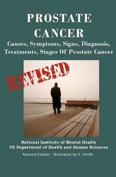 Paperback Prostate Cancer: Causes, Symptoms, Signs, Diagnosis, Treatments, Stages. What You Need to Know About Prostate Cancer Book