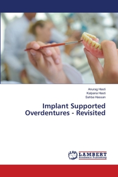 Paperback Implant Supported Overdentures - Revisited Book