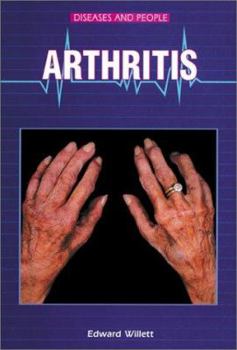 Library Binding Arthritis Book