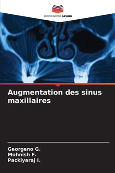 Paperback Augmentation des sinus maxillaires [French] Book