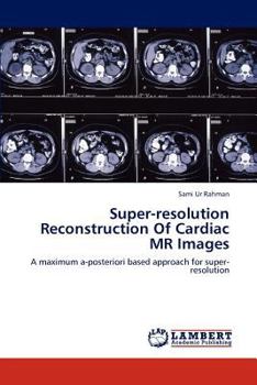 Paperback Super-resolution Reconstruction Of Cardiac MR Images Book