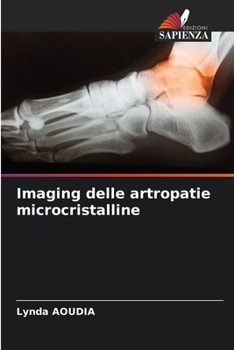 Imaging delle artropatie microcristalline (Italian Edition)
