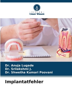 Paperback Implantatfehler [German] Book