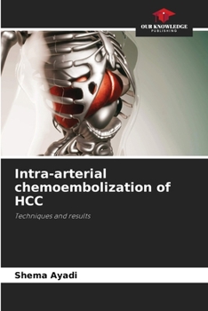 Paperback Intra-arterial chemoembolization of HCC Book