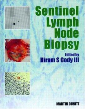 Hardcover Sentinel Lymph Node Biopsy Book