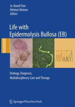 Hardcover Life with Epidermolysis Bullosa (EB): Etiology, Diagnosis, Multidisciplinary Care and Therapy Book