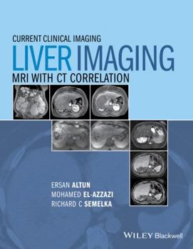 Hardcover Liver Imaging: MRI with CT Correlation Book