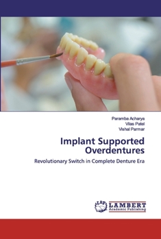 Paperback Implant Supported Overdentures Book