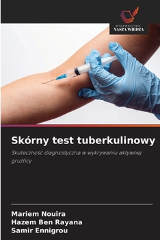 Paperback Skórny test tuberkulinowy [Polish] Book