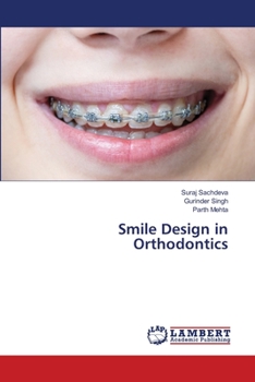 Paperback Smile Design in Orthodontics Book