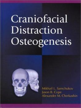 Hardcover Craniofacial Distraction Osteogenesis Book