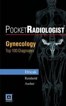 Paperback Pocketradiologist - Gynecology: Top 100 Diagnoses Book