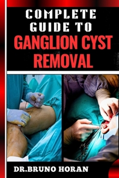 COMPLETE GUIDE TO GANGLION CYST REMOVAL: Comprehensive Handbook To Expert Techniques, Home Remedies, And Post Surgery Care For Pain Relief And Healing