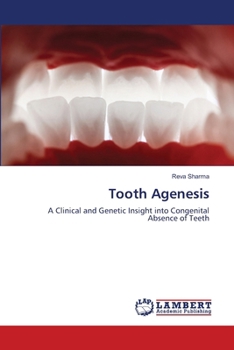Tooth Agenesis