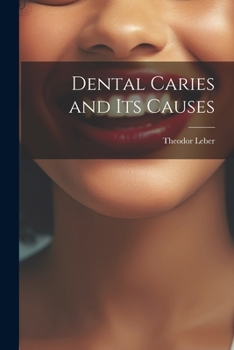 Paperback Dental Caries and Its Causes Book