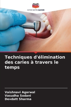 Paperback Techniques d'élimination des caries à travers le temps [French] Book