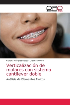 Paperback Verticalización de molares con sistema cantilever doble [Spanish] Book