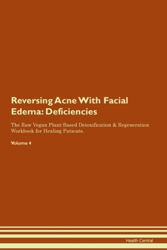 Paperback Reversing Acne With Facial Edema: Deficiencies The Raw Vegan Plant-Based Detoxification & Regeneration Workbook for Healing Patients. Volume 4 Book